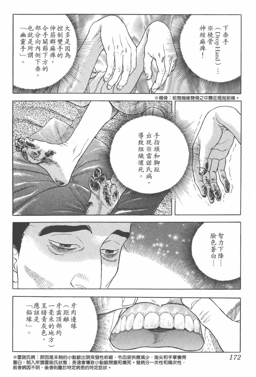 第171页