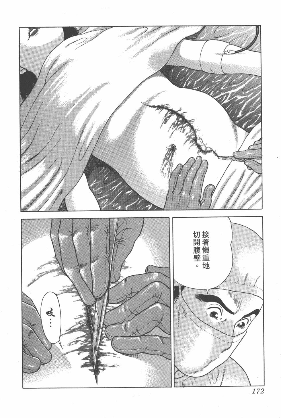 第170页