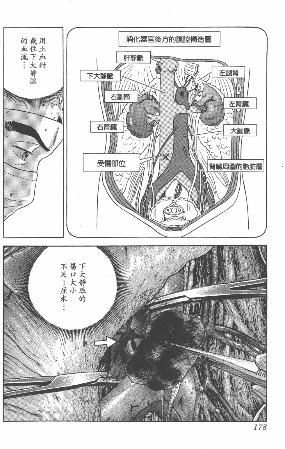 第176页